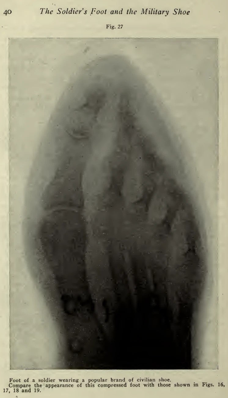 X-ray of a soldier's foot compressed by a civilian shoe, Fig. 27 from The Soldier's Foot and the Military Shoe